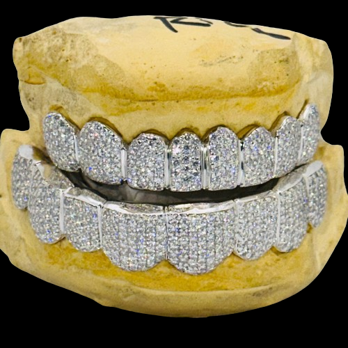 Top 5 Questions About Grillz