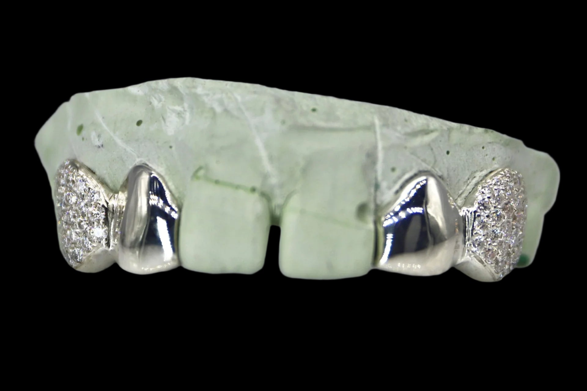 VVS Moissanite 2 Teeth Diamond Grillz with Solid Ends