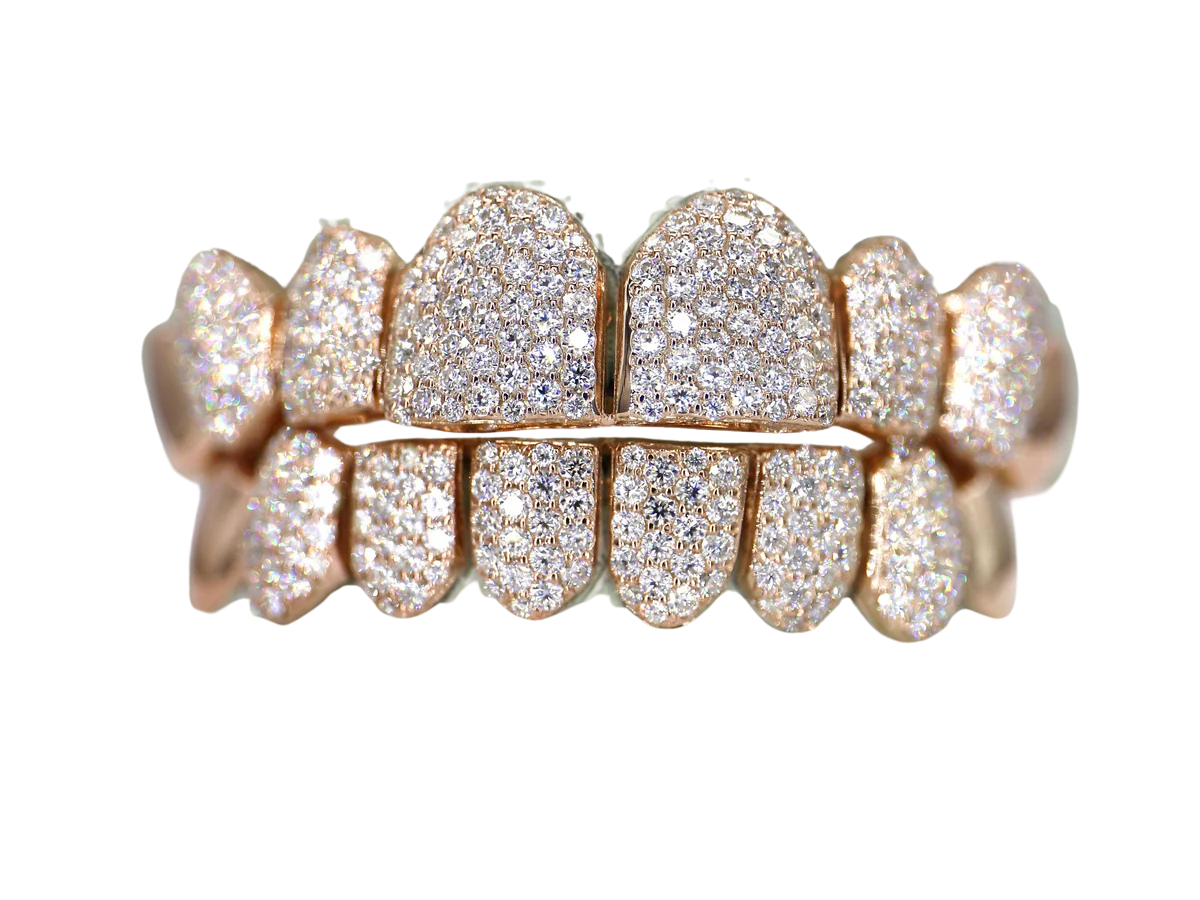 VVS Moissanite 8 On 8 Capped Diamond Grillz