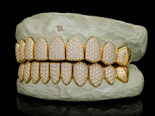 TYS GRILLZ custom gold moissanite grillz upper and lower teeth alignment