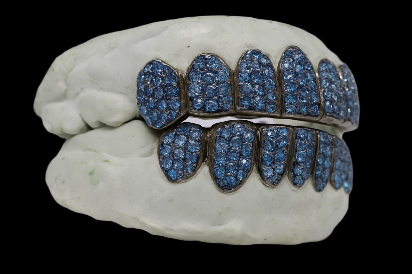 Custom VVS Moissanite Ice Blue Diamond Grillz