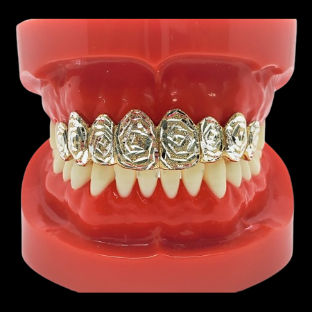Rose pattern gold grillz covering eight upper teeth on dental model