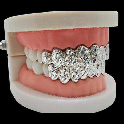 Custom nugget cut silver grillz on dental model showing full upper and lower fit