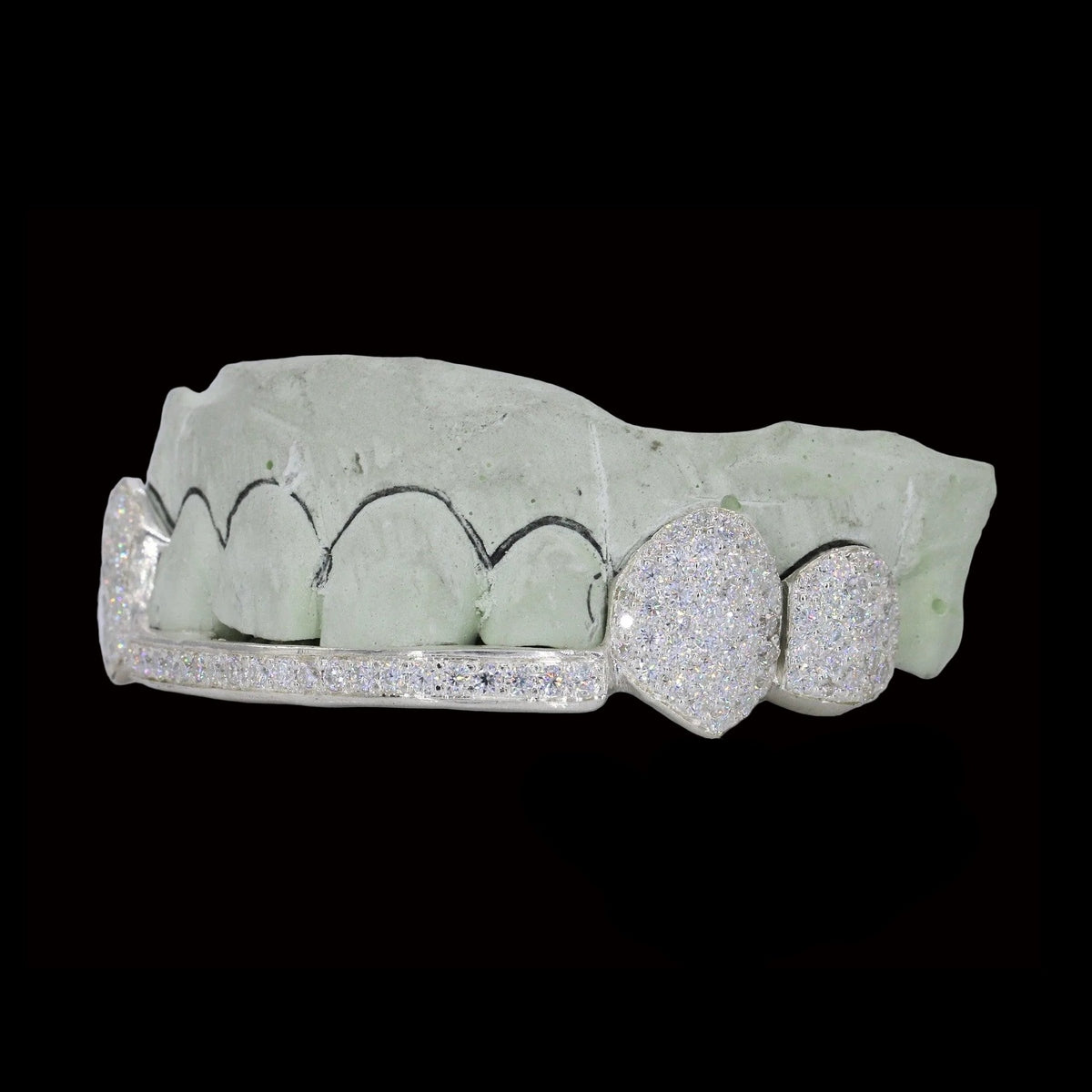 Asymmetrical white gold moissanite fang grillz with round stones and micro-pave bar side view
