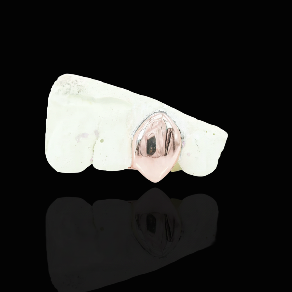 CUSTOM ONE TOOTH (CAP GRILLZ) GOLD GRILLZ
