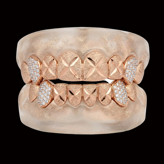 Custom 8 on 8 Teeth Diamond Cut & Diamond Dust Grillz with Bussdown on Fangs