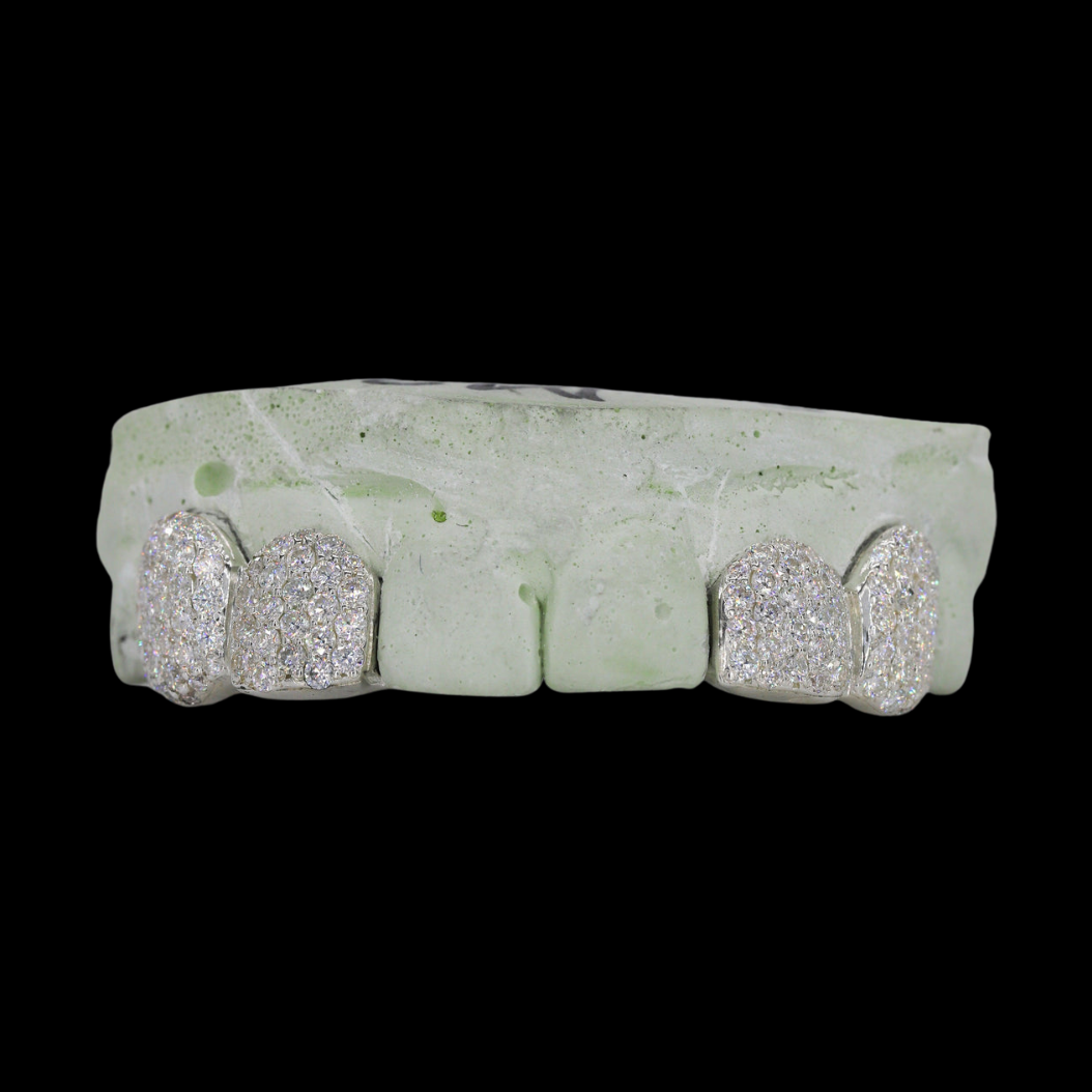 Silver VVS Moissanite 4 Teeth Grillz Set on Canines and Incisors