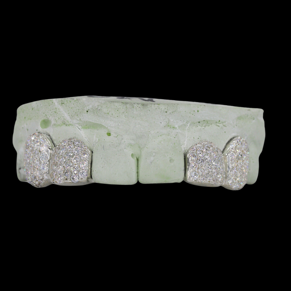 Iced Out 2 Teeth VVS Moissanite Diamond Grillz