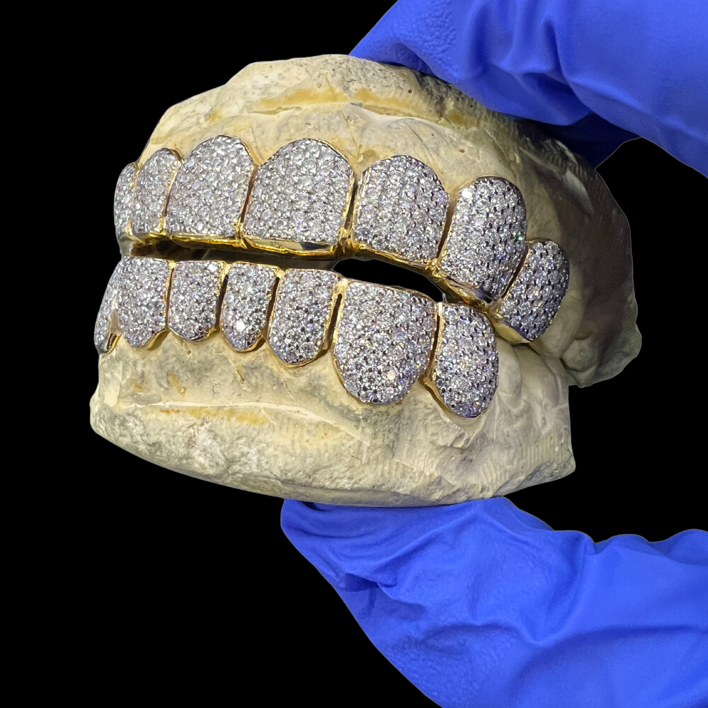 Moisannite VVS 12 On 12 Diamond Grillz