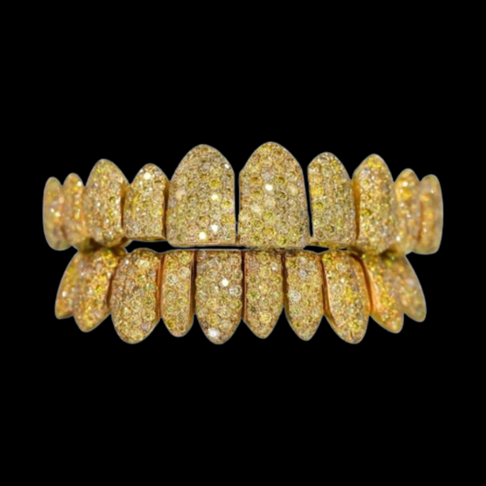 VVS yellow canary moissanite diamond grillz in 14k gold with dense pave setting and bright sparkle