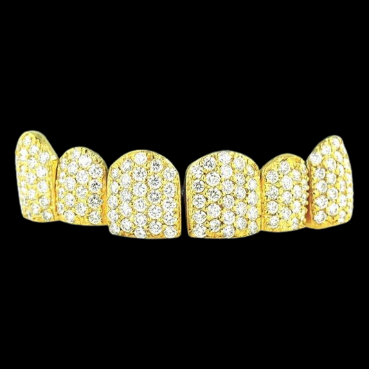 18k Individual Diamond Prong Set Permanent Teeth Grillz