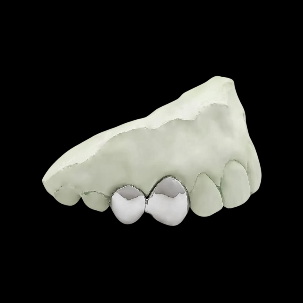 CUSTOM ANY 2 TEETH (CONNECTED) GOLD GRILLZ.