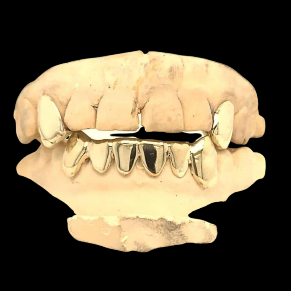 CUSTOM 2 TEETH WITH EXTENDED FANGS & 6 BOTTOM GOLD GRILLZ