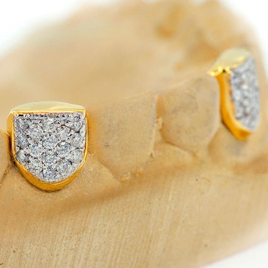 Custom 2 Teeth Incisors Diamond Grillz with Back Bar - Premium Authentic Fit