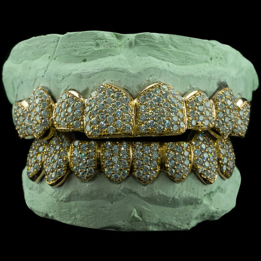 Custom Iced VVS Moissanite Zig Zag Setting Grillz