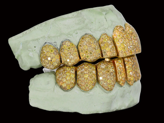 VVS Yellow Canary Moissanite Diamond Grillz