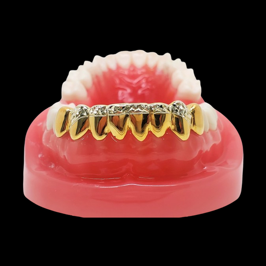 Top View of Custom 18K Gold and Silver Diamond Cut Teeth Grillz