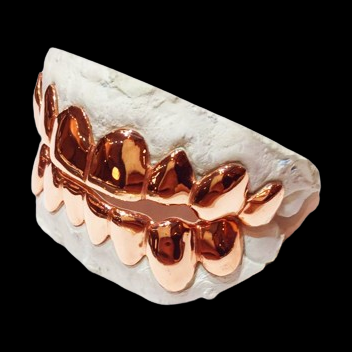 Side view of polished 18K rose gold plated removable grillz