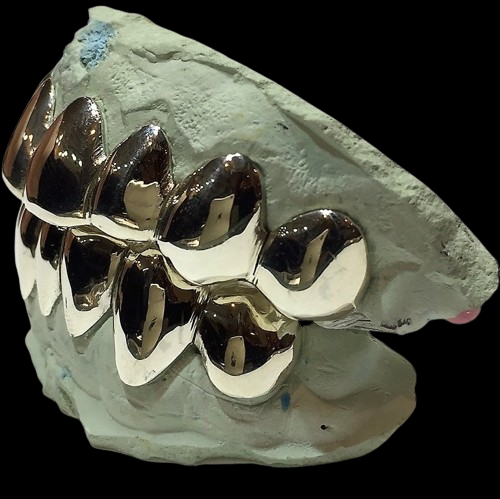Custom 10K Solid White Gold Custom fit REAL Perm Cut Grillz