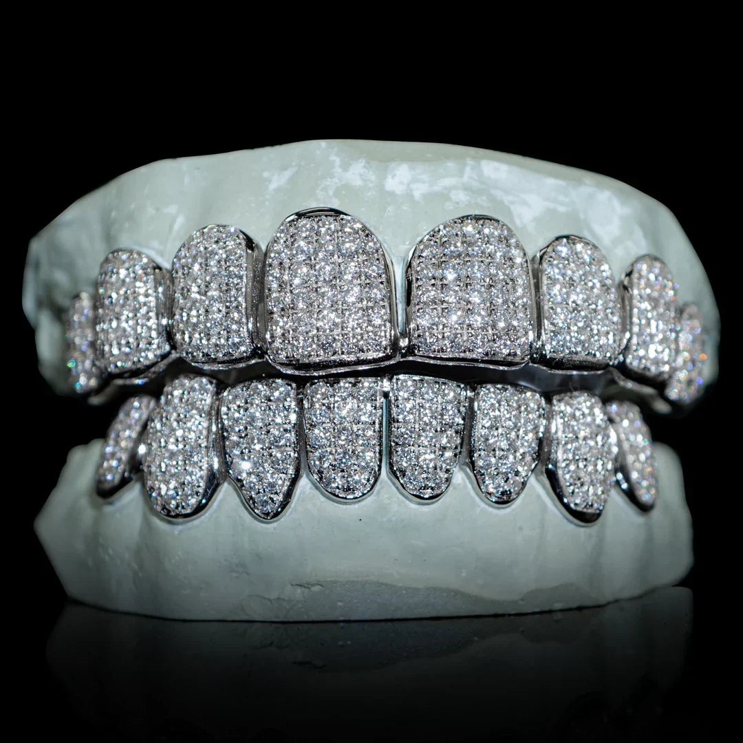 Are Grillz OK for Your Teeth?