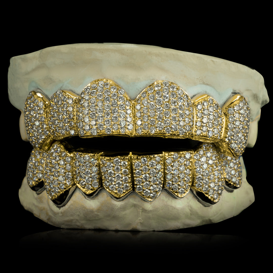 Moissanite Grillz