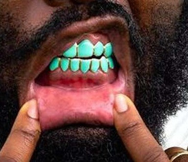 Custom 8 On 8 Tobe Nwigwe 'Mint Condition' Gold Grillz