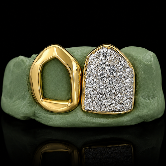 18K Hand Prong Set And Open Face Grillz