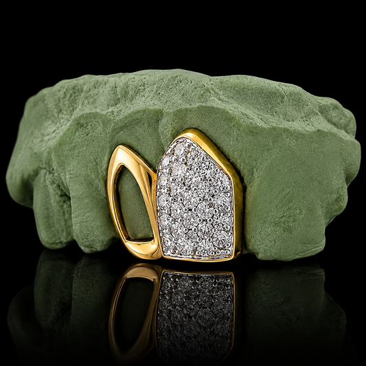 18K Hand Prong Set And Open Face Grillz