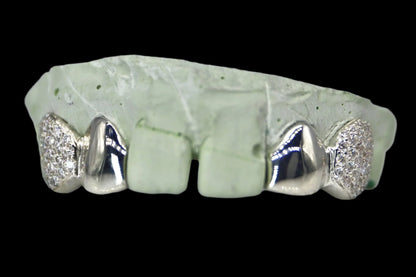 VVS Moissanite 2 Teeth Diamond Grillz with Solid Ends
