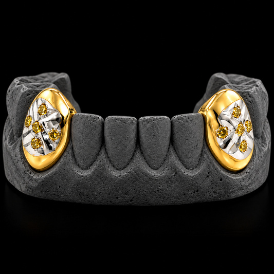 2 Gold Fang Teeth With Diamonds, yellow gold and silver grillz with pave-set stones