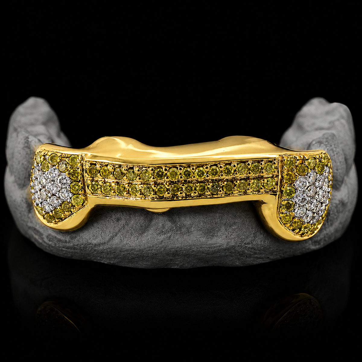 3 Hand Prong Set Diamond Grillz