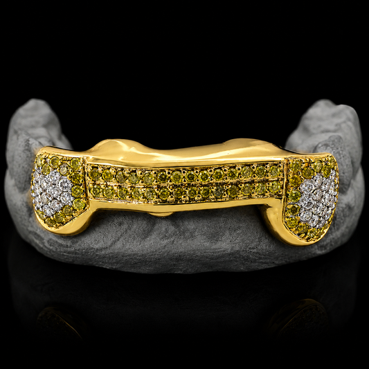3 Hand Prong Set Diamond Grillz