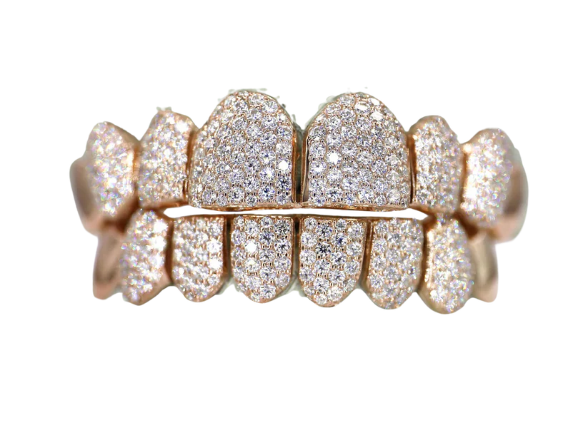 8 on 8 VVS Moissanite Diamond Grillz