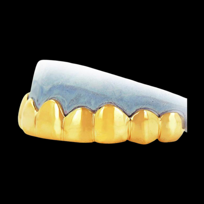 8 Piece Solid Gold Grillz.