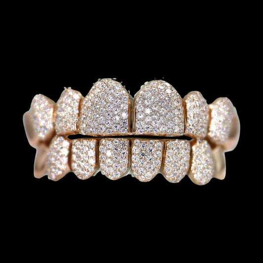 Rose gold 8 on 8 VVS Moissanite diamond grillz with full-coverage micro-pave stones