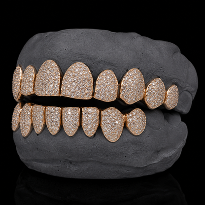 8 on 8 VVS Moissanite Diamond Grillz