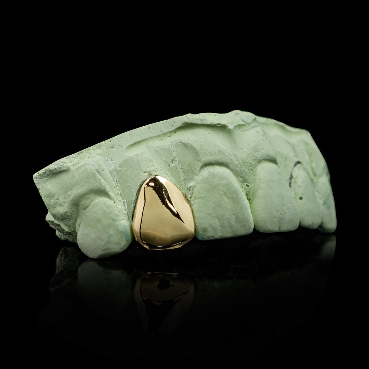 Gold plated single tooth polished grillz on lower jaw dental mold