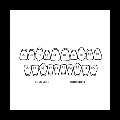 Custom grillz tooth placement diagram showing upper and lower rows