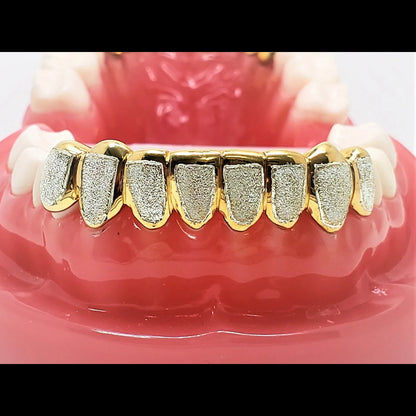 Two-tone diamond dust cut grillz with yellow gold edges and silver textured centers on dental model