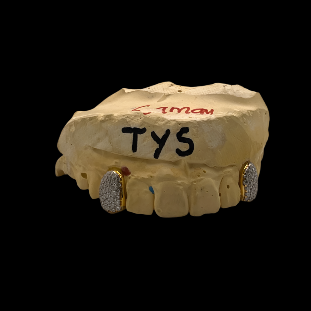 2 Iced Out Vvs Moissanite Diamond Grillz