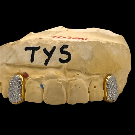 2 Iced Out Vvs Moissanite Diamond Grillz