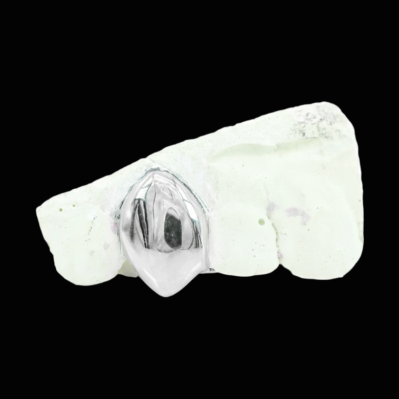 CUSTOM ONE TOOTH (CAP GRILLZ) GOLD GRILLZ