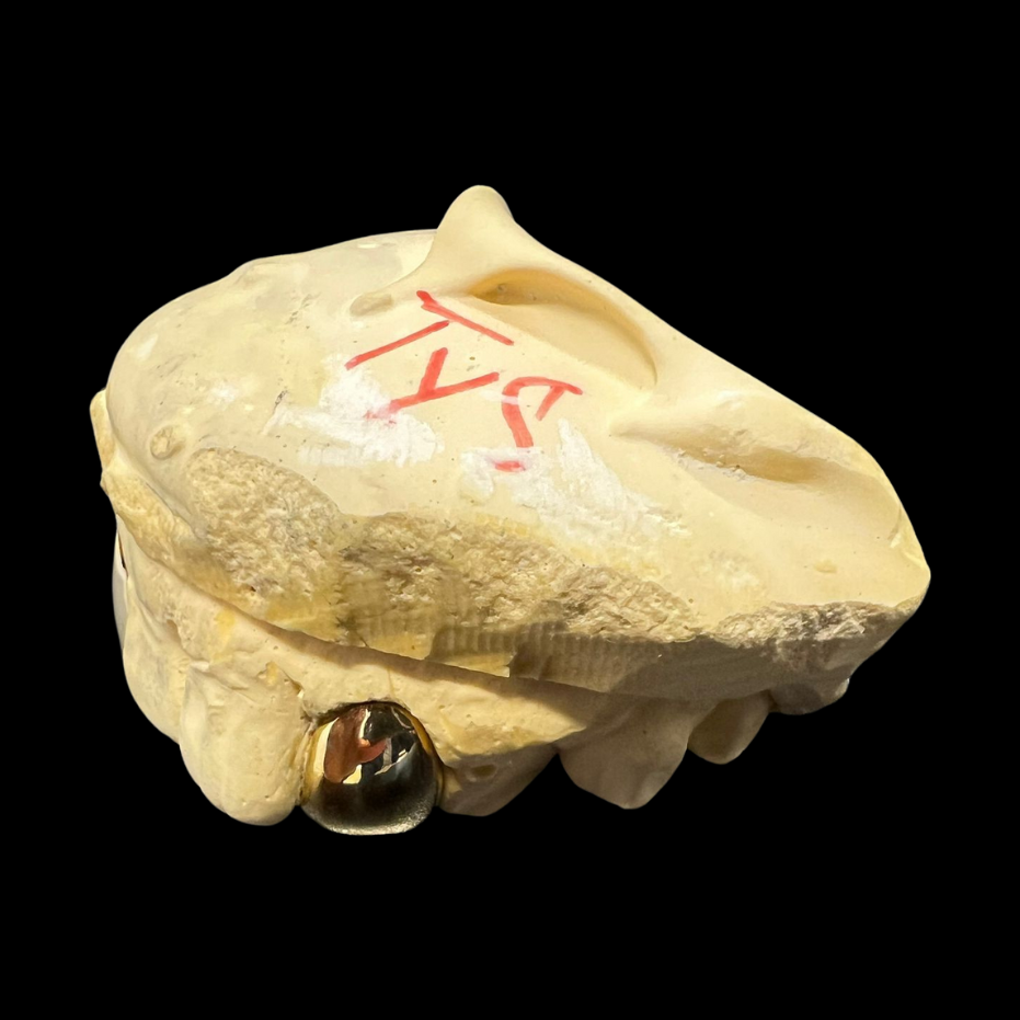 CUSTOM ONE TOOTH (CAP GRILLZ) GOLD GRILLZ.