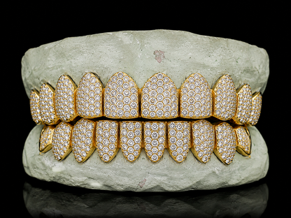 TYS GRILLZ 10K gold capped diamond grillz dense pave stone detail
