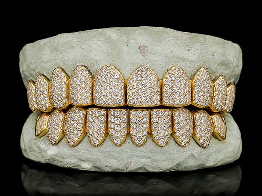 TYS GRILLZ 10K gold capped diamond grillz dense pave stone detail