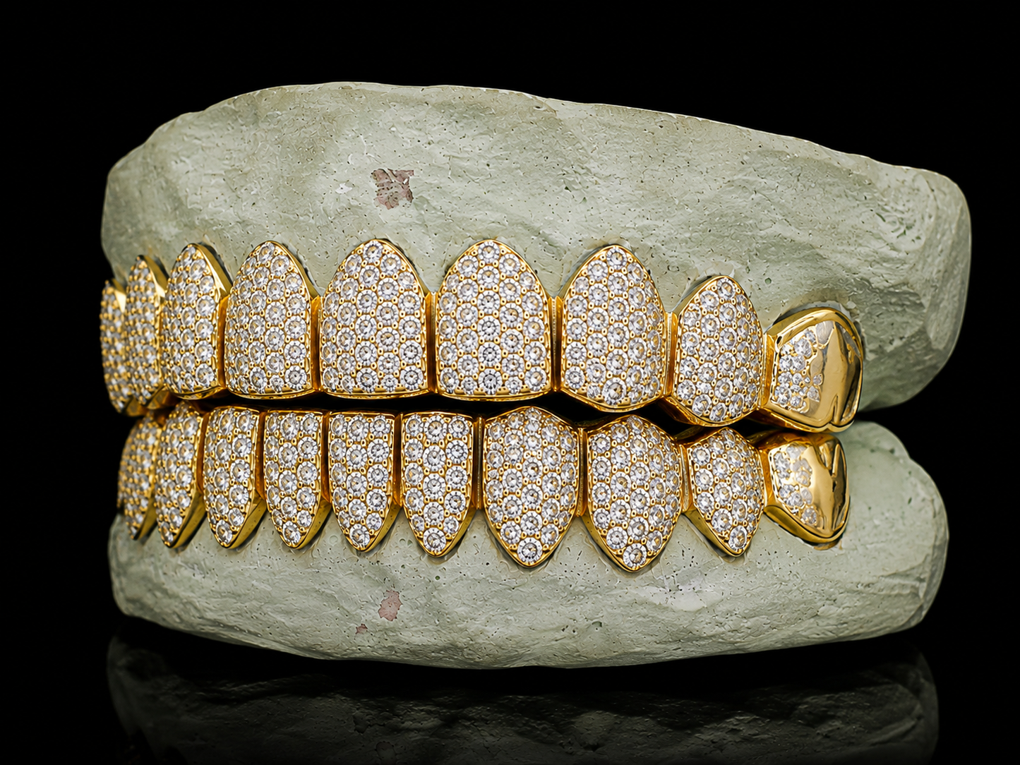 TYS GRILLZ custom gold moissanite grillz upper and lower teeth alignment