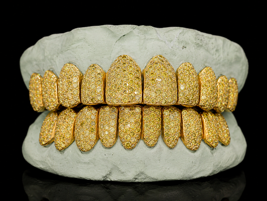 VVS Yellow Canary Moissanite Diamond Grillz