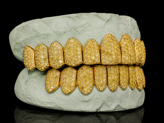 VVS Yellow Canary Moissanite Diamond Grillz