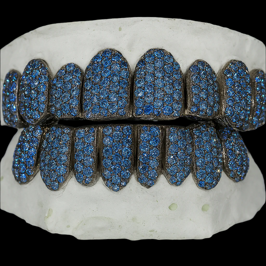 Custom VVS Moissanite Ice Blue Diamond Grillz