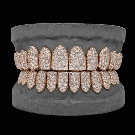 VVS Moissanite Snow Diamond Grillz